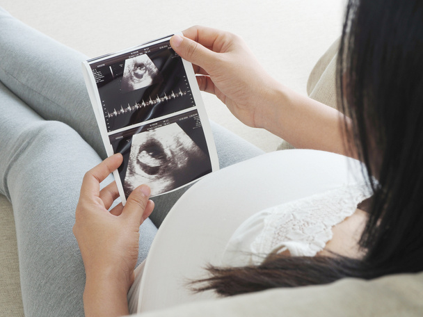 Pregnant woman holding ultrasound scan. Concept of pregnancy health care. - 写真・画像