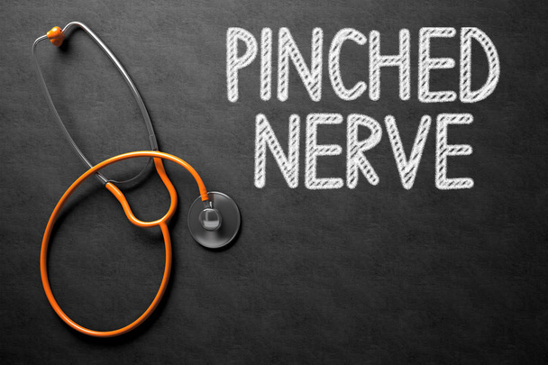 Крейдова дошка з концепцією Pinched Nerve. 3D ілюстрації
. - Фото, зображення