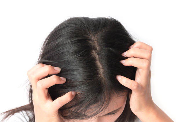 Lähikuva nainen käsi kutiava päänahka, Hiustenhoito käsite
 - Valokuva, kuva