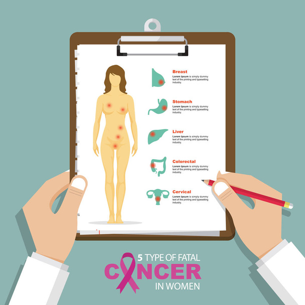 infográfico para top 5 tipo de câncer fatal em mulheres em design plano. Área de transferência na mão do médico. Relatório médico e de cuidados de saúde
. - Vetor, Imagem