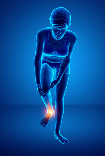 Pé feminino com dor no tornozelo
 - Foto, Imagem