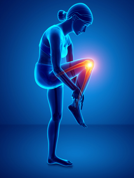 Bóle stawów kolanowych kobiet - Zdjęcie, obraz