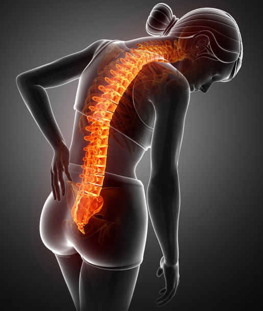 Mujeres sintiendo el dolor de espalda
  - Foto, Imagen