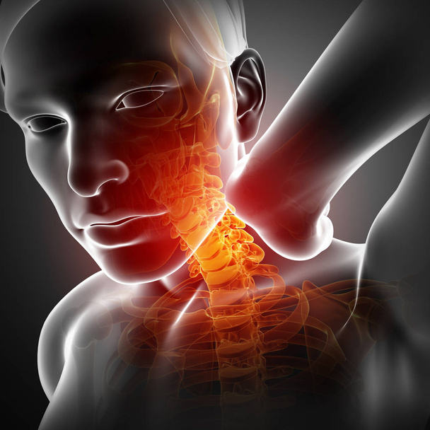 Férfi érzés a nyaki fájdalom - Fotó, kép