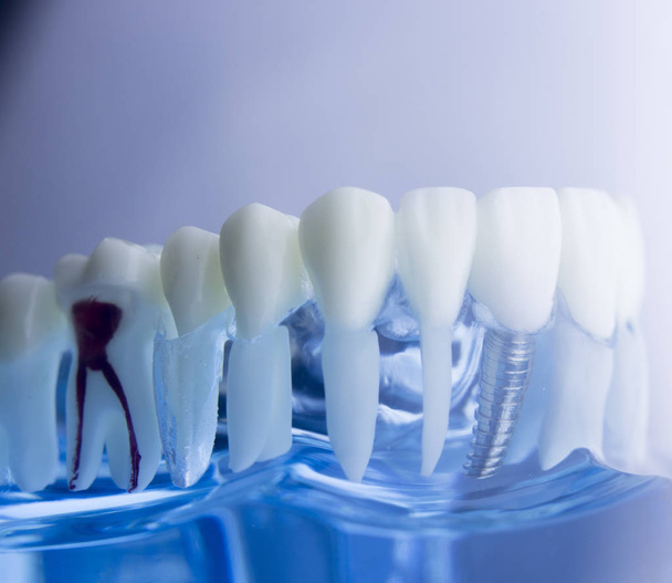 Dental teeth dentistry model - Foto, immagini