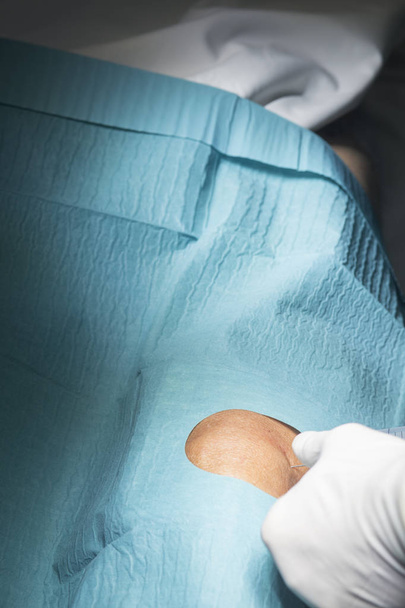 Knee surgery surgical operation - Фото, изображение