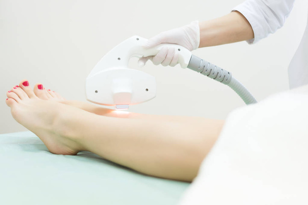 Laser hair removal on ladies legs - Valokuva, kuva