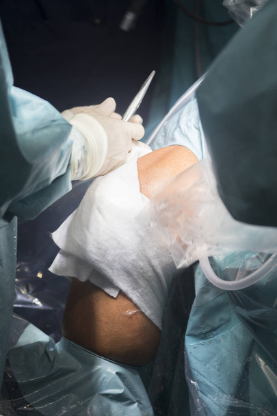 Knee surgery nurse bandaging - Photo, Image