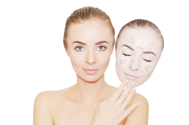 woman takes away mask with acne and pimples,white background - 写真・画像