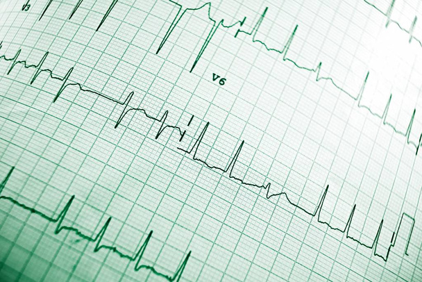 Électrocardiogramme en gros plan
 - Photo, image