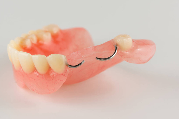 acrylic denture with metal clasps - Photo, Image