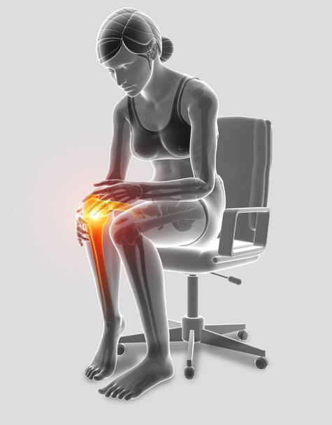 3d ilustração de mulheres sentindo dor no joelho
 - Foto, Imagem
