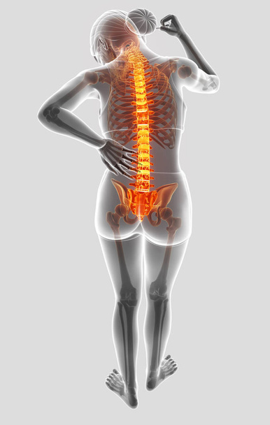 3 d 女性感の図の背中の痛み - 写真・画像