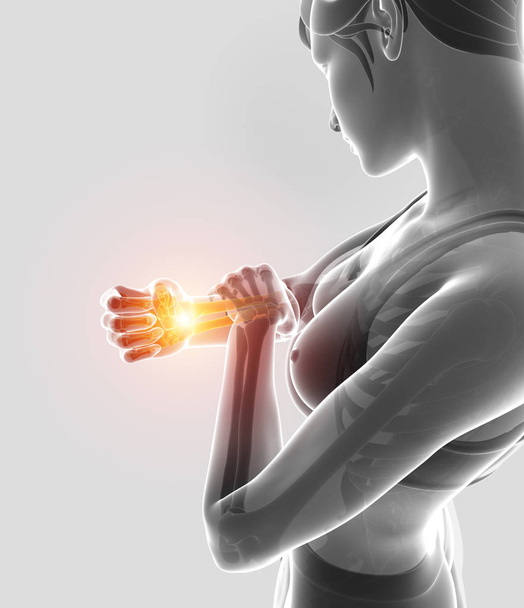 3D Illustration von Frauen, die Schmerzen im Ellbogen spüren - Foto, Bild