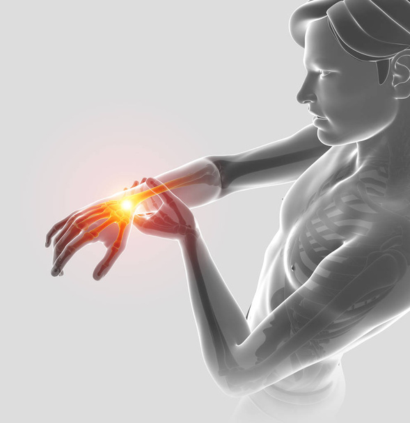 3D απεικόνιση του άνδρες συναίσθημα αγκώνα πόνο - Φωτογραφία, εικόνα