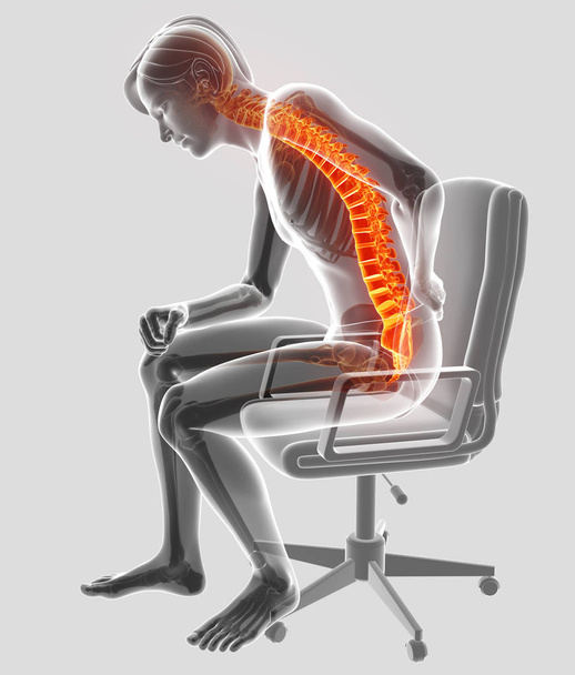 Ilustración 3D del varón Sintiendo el dolor de espalda
 - Foto, Imagen