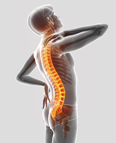 Ilustración 3D del varón Sintiendo el dolor de espalda
 - Foto, Imagen