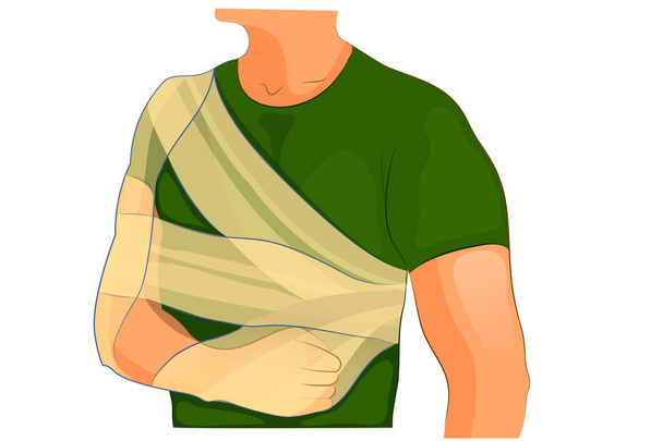 bendaggio trauma desault spalla e braccio
 - Vettoriali, immagini