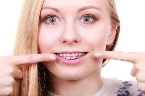 Happy woman showing her braces on teeth - Фото, изображение