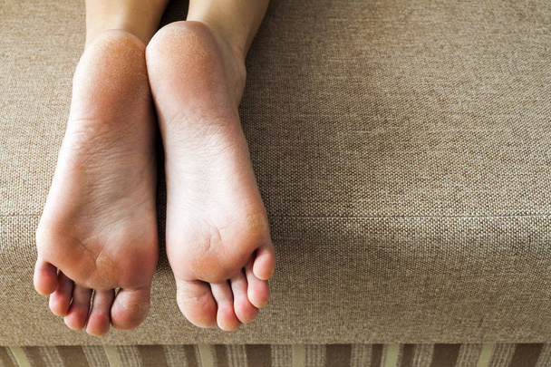 Ξηρό σκασμένο δέρμα των ποδιών γυναίκα στο κρεβάτι. Περιποίηση ποδιών. - Φωτογραφία, εικόνα