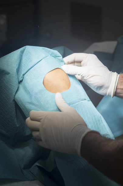 Cirugía de rodilla operación quirúrgica
 - Foto, Imagen