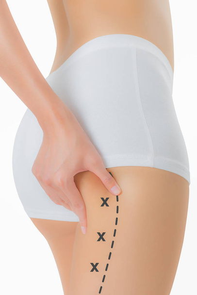 Woman grabbing skin on her buttock with the black color crosses marking, Lose weight and liposuction cellulite removal concept, Isolated on white background. - Foto, Imagen