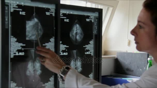 Jovem Médica Exemplos dos Resultados da Pesquisa de Câncer de Mama do Paciente Famale no Computador
 - Filmagem, Vídeo