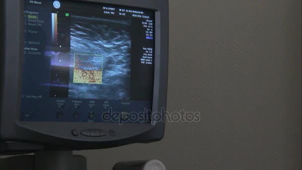 Ultraschall der Patientin famale Brust - Filmmaterial, Video