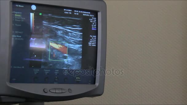 Ultrasoud de mama Famale paciente
 - Metraje, vídeo