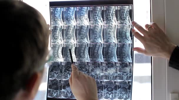 Dos médicos examinan a los pacientes radiografías en el hospital
 - Metraje, vídeo