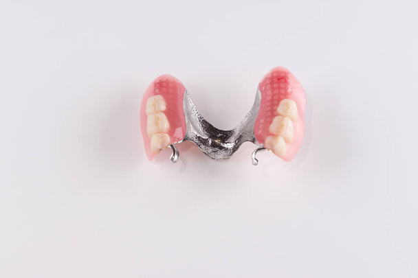 Clasp prosthesis with attachments fixing ceramic crowns - Photo, Image
