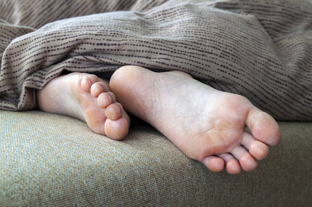 ベッドで女性の足のひびの入った皮膚を乾燥させます。足の治療. - 写真・画像