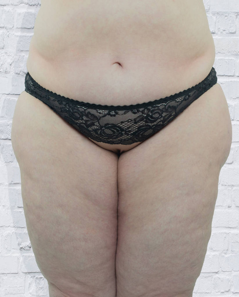 Žena s obezitou ukazuje části těla postižených - Fotografie, Obrázek