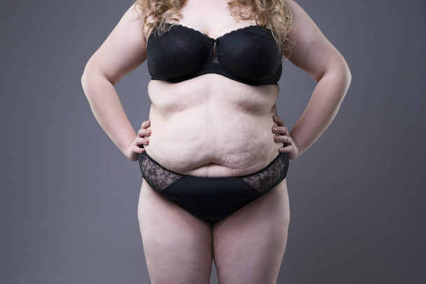 Plus size model in black lingerie, overweight female body, fat woman with stretch marks on gray background - Zdjęcie, obraz