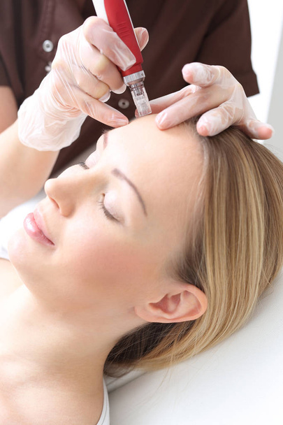 Needle Mesotherapy, face lift - Photo, Image