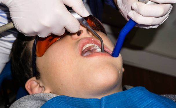 chlapec v zubní ošetření. složená závorka. zdravotní péče - Fotografie, Obrázek