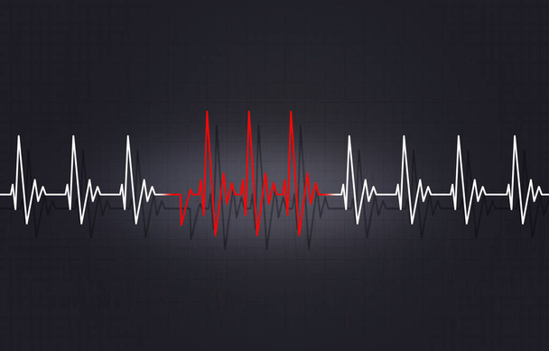 Arritmia Ilustração irregular do batimento cardíaco
 - Foto, Imagem