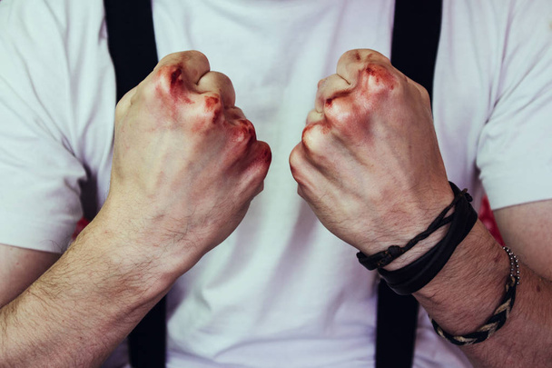 man with damaged hands  - Valokuva, kuva