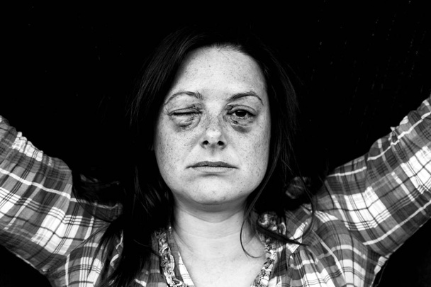 Žena s pohmožděnou očima - Fotografie, Obrázek