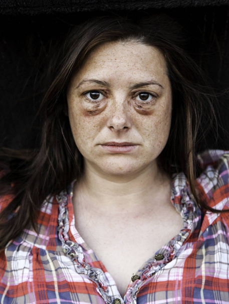 Vrouw met gekneusd ogen - Foto, afbeelding