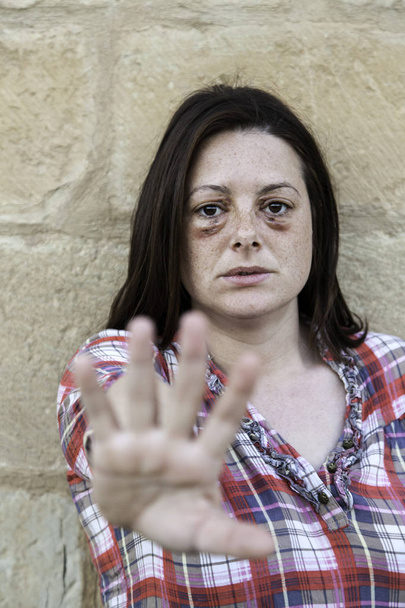 Mulher com olhos machucados
 - Foto, Imagem