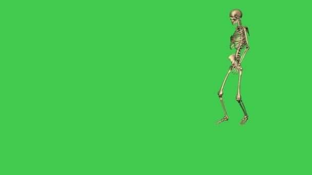 skeleton walking hurt   - separate on green screen - Footage, Video