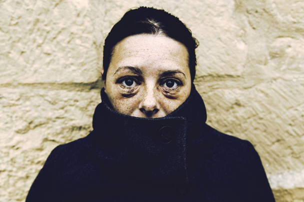 Γυναίκα με μάτια μελανιασμένο - Φωτογραφία, εικόνα