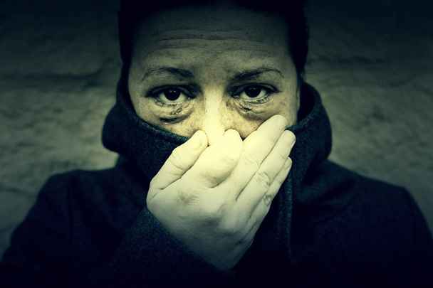 Çürük gözlü kadın - Fotoğraf, Görsel
