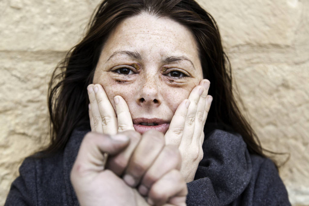 Woman with bruised eyes - Photo, Image