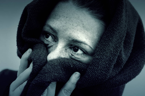 Femme battue avec les yeux endommagés
 - Photo, image