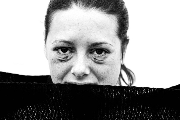 Pahoinpidelty nainen, jonka silmät ovat vahingoittuneet
 - Valokuva, kuva
