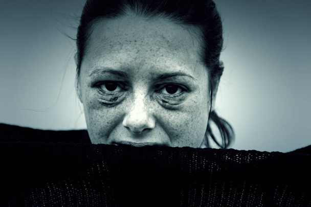 Femme battue avec les yeux endommagés
 - Photo, image