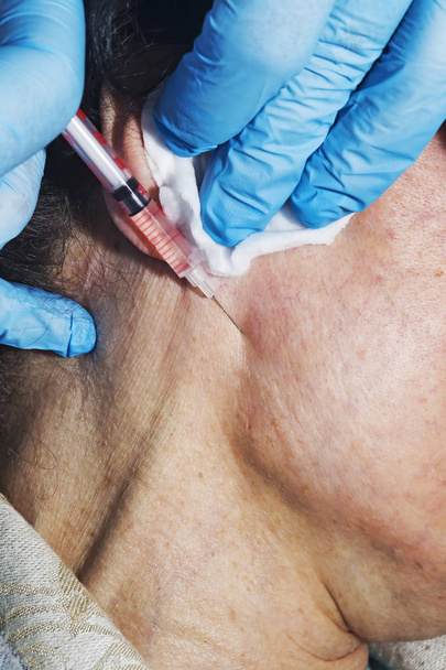 Dermatolog kozmetolojist güzellik kliniğinde orta yaşlı bir hastaya botulinum toksini kozmetik enjeksiyon uyguluyor - Fotoğraf, Görsel