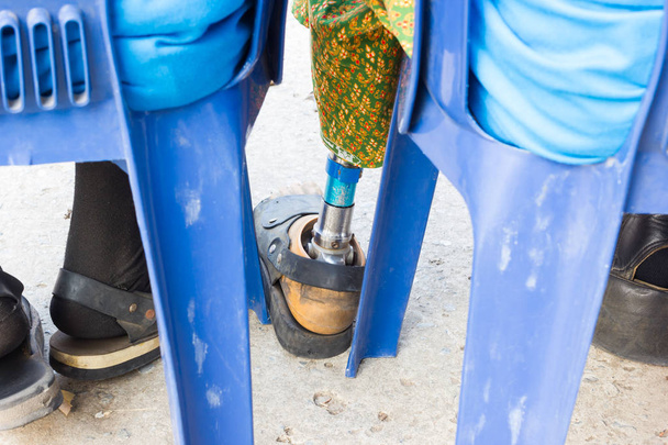Closeup Aziatische oude vrouw met aluminium prothesen op blauwe stoel - Foto, afbeelding